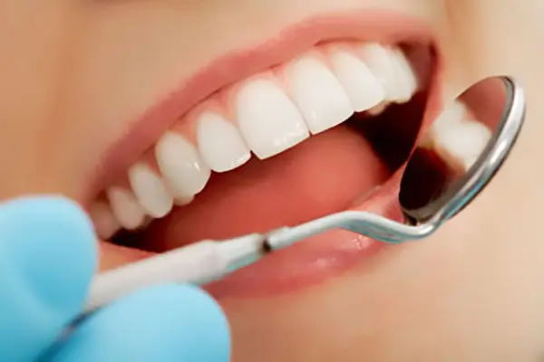 General dentistry services in Carmarthen